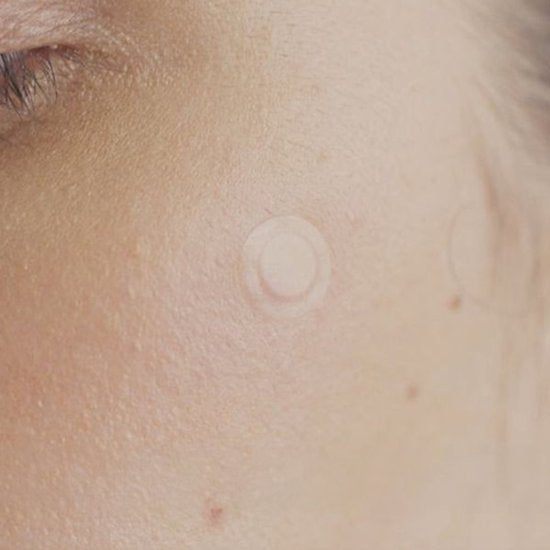 Tea-Trica Spot Cover Patch - 22 patches